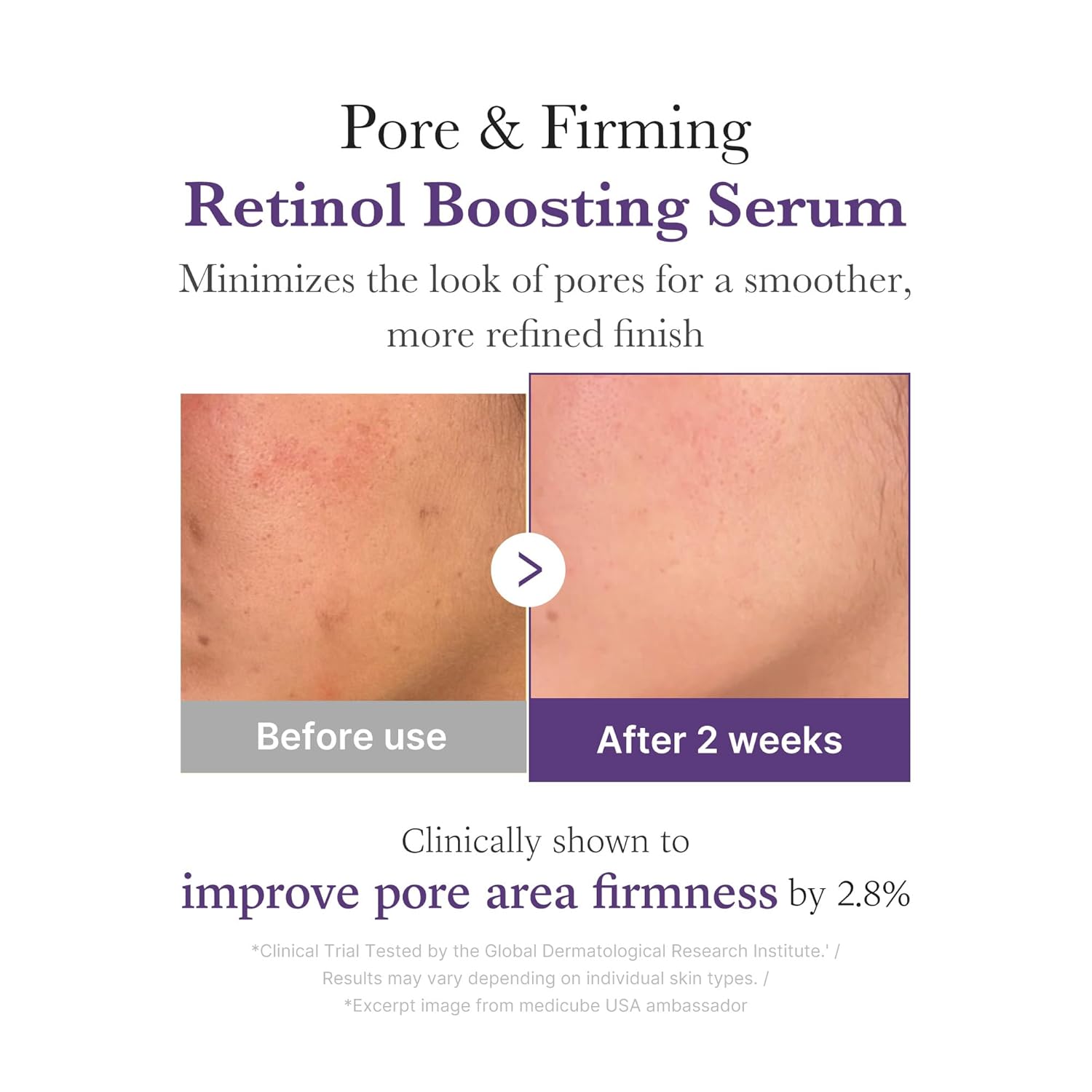 Medicube Retinol-some 1.9% NMN Boosting Serum