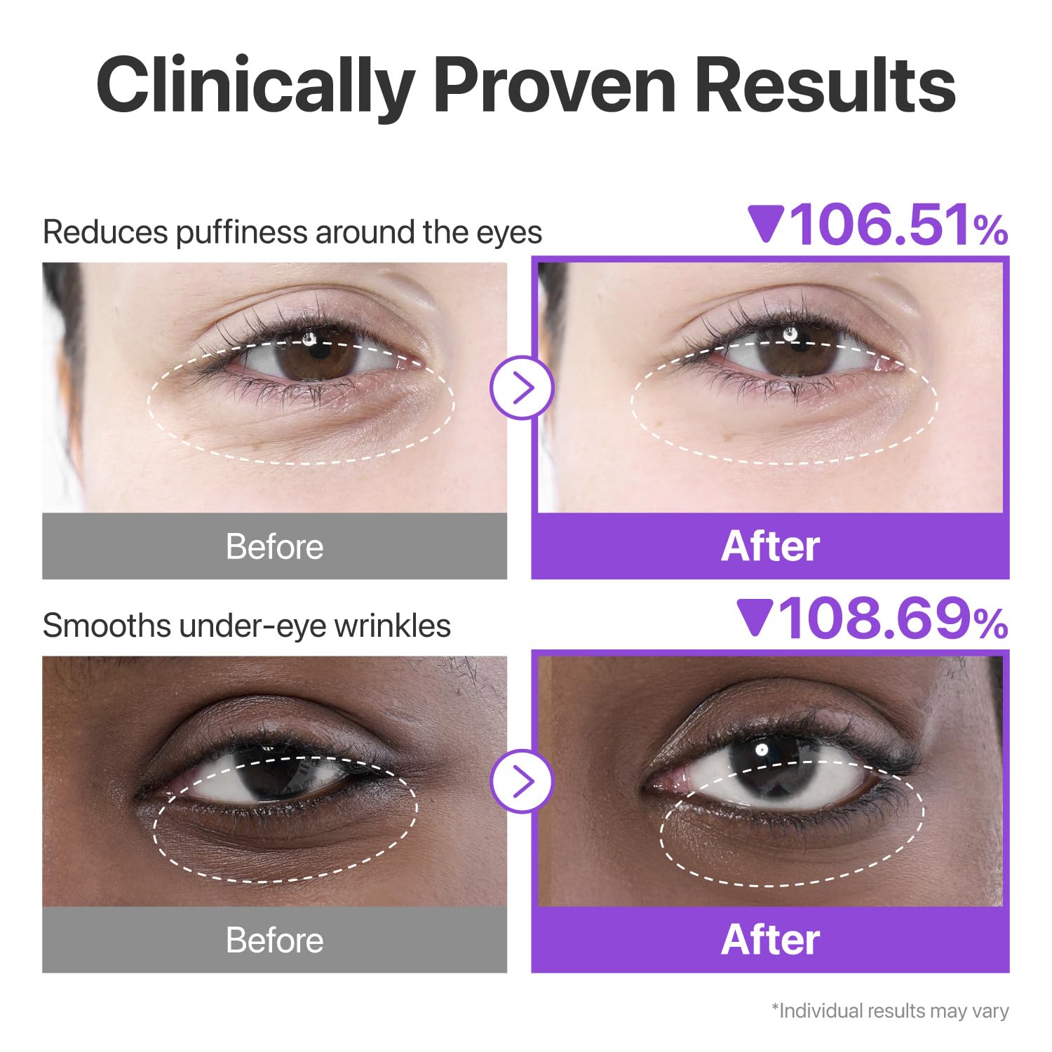 Numbuzin No.9 Eye Patches — NAD+ Collagen Gel Under-Eye Masks