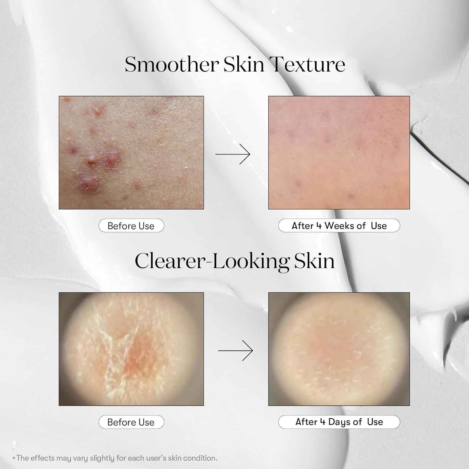 VT COSMETICS CICA REEDLE SHOT 300