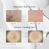 VT COSMETICS CICA REEDLE SHOT 300