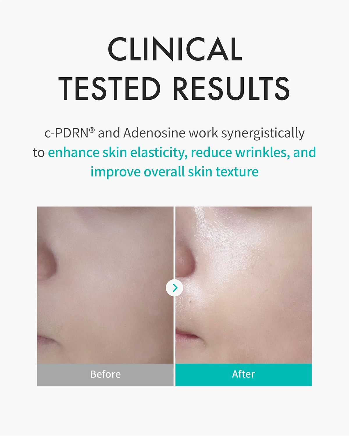 REJURAN Turnover Mask c-PDRN (Pack of 5ea)